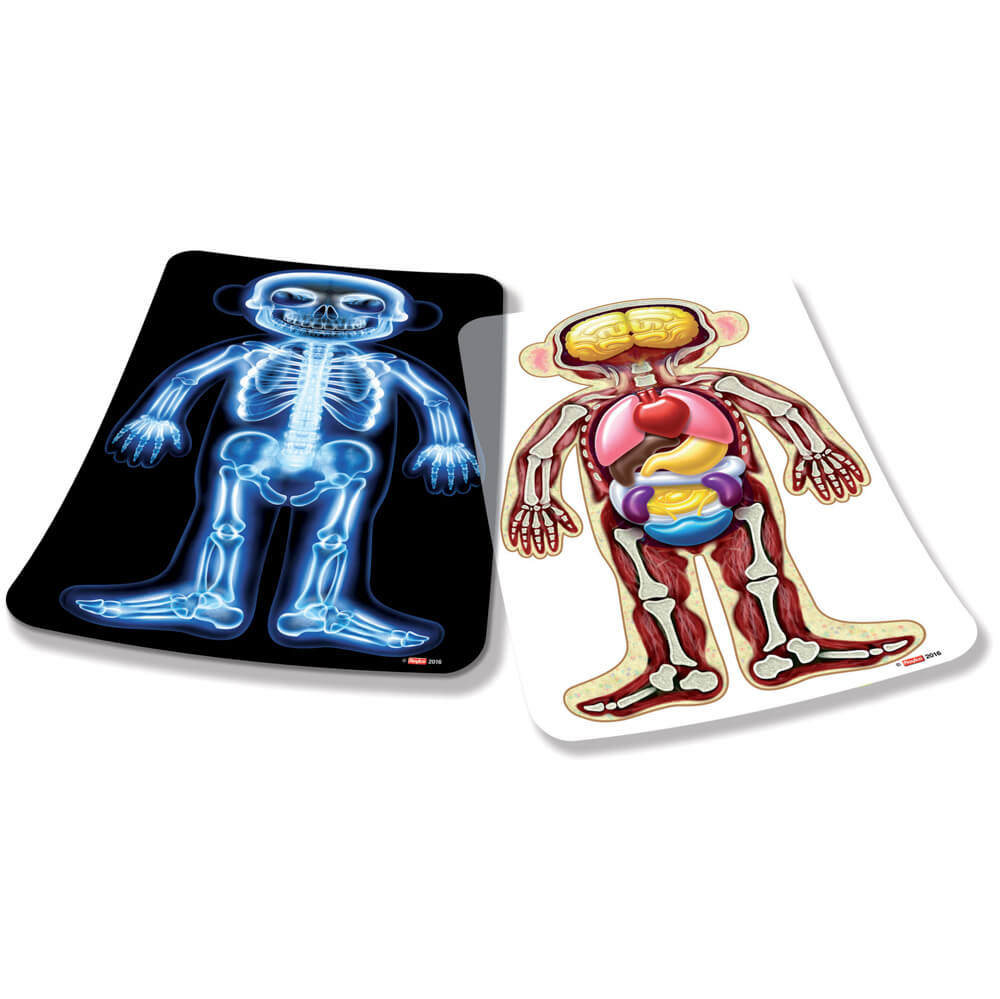 Røntgenbillede og scanning fra Roylco af bamse