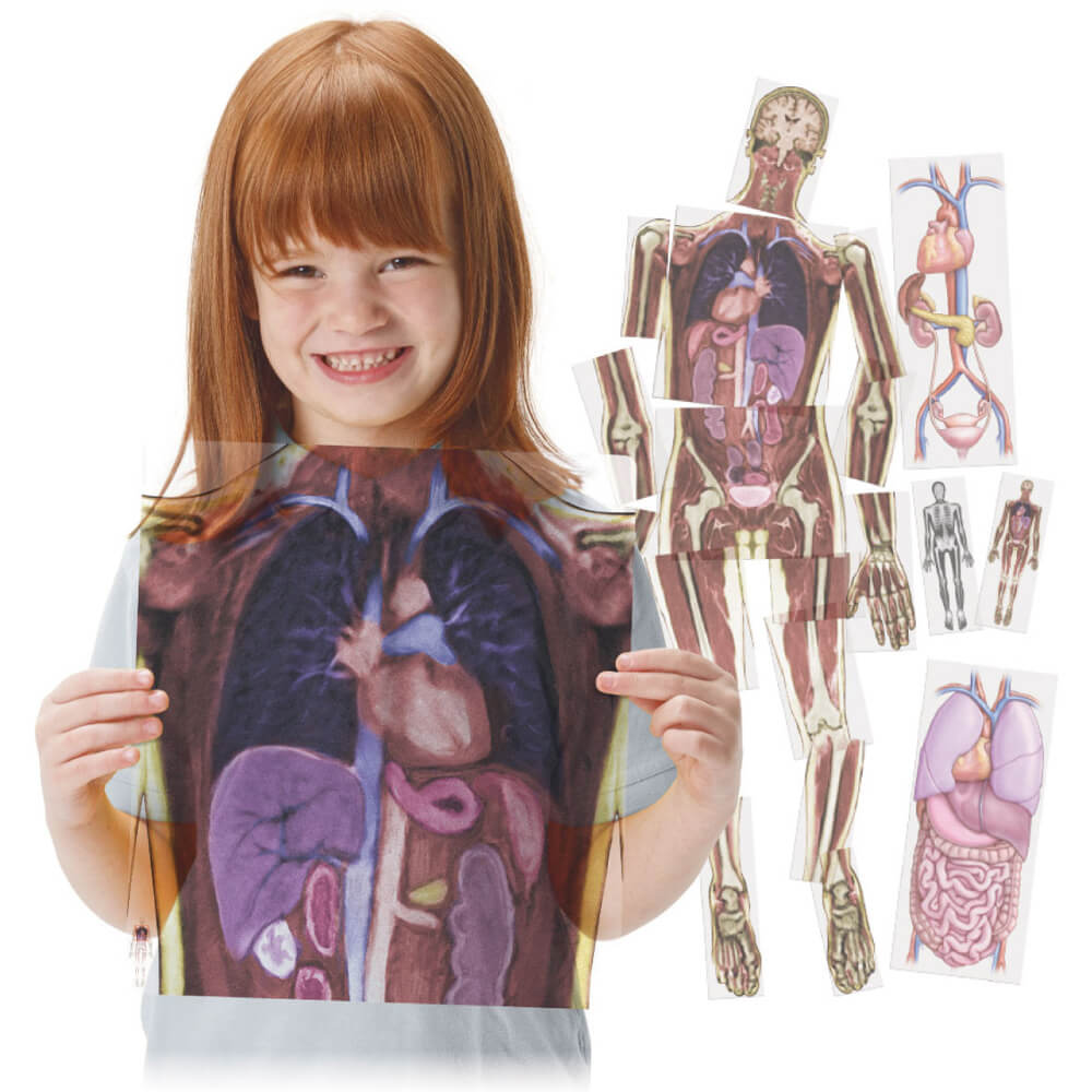 MR-scanningsbilleder fra Roylco 